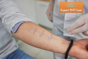 Blood collection by a medical expert from a patient at Expert ENT Care in Fort Worth, TX 